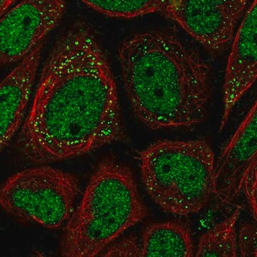 Anti-PNPLA2 antibody produced in rabbit Prestige Antibodies&#174; Powered by Atlas Antibodies, affinity isolated antibody