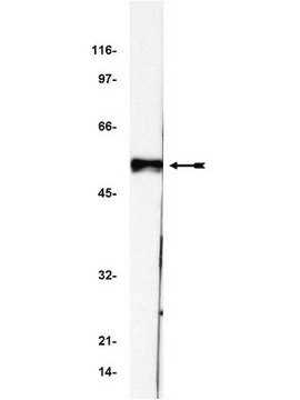 Anti-p53 Antibody, clone BP53-12 clone BP53-12, Upstate&#174;, from mouse