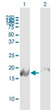 Anti-NDUFB6 antibody produced in mouse IgG fraction of antiserum, buffered aqueous solution