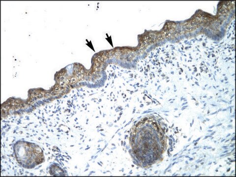 Anti-MYBL2 affinity isolated antibody