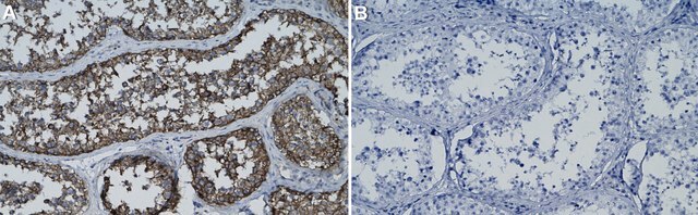 Anti-&#945; Tubulin Antibody, clone 2F2 ZooMAb&#174; Rabbit Monoclonal recombinant, expressed in HEK 293 cells