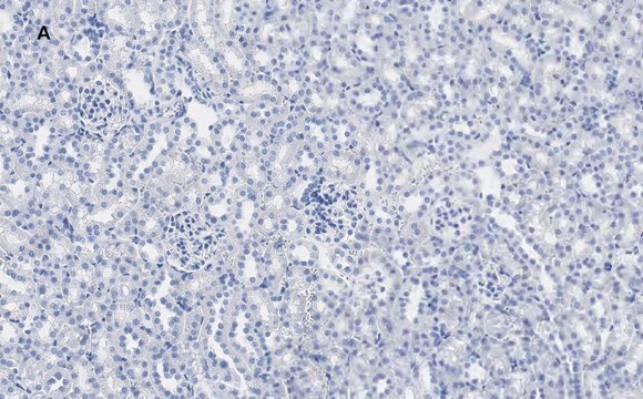 Anti-Calbindin D-28K clone 1A11 Antibody, ZooMAb&#174; Rabbit Monoclonal recombinant, expressed in HEK 293 cells