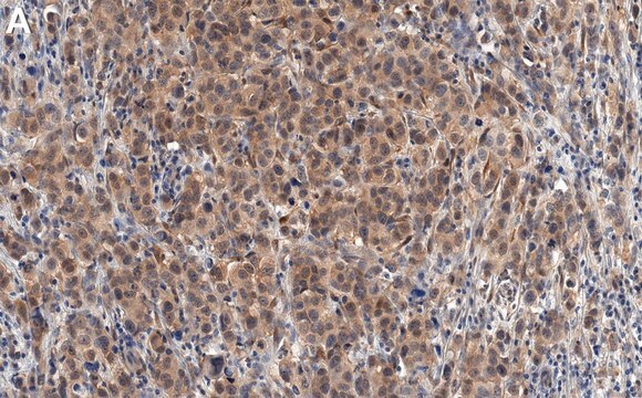 Anti-PTEN Antibody, clone 6H2.1 ZooMAb&#174; Mouse Monoclonal recombinant, expressed in HEK 293 cells