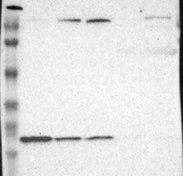 Anti-WDHD1 antibody produced in rabbit Prestige Antibodies&#174; Powered by Atlas Antibodies, affinity isolated antibody, buffered aqueous glycerol solution