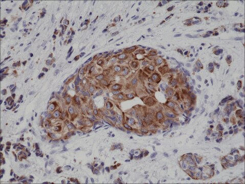 Anti-Cytokeratin 18 antibody, Rabbit monoclonal recombinant, expressed in HEK 293 cells, clone RM279, purified immunoglobulin