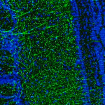 Anti-DPP6 antibody produced in rabbit Prestige Antibodies&#174; Powered by Atlas Antibodies, affinity isolated antibody, buffered aqueous glycerol solution