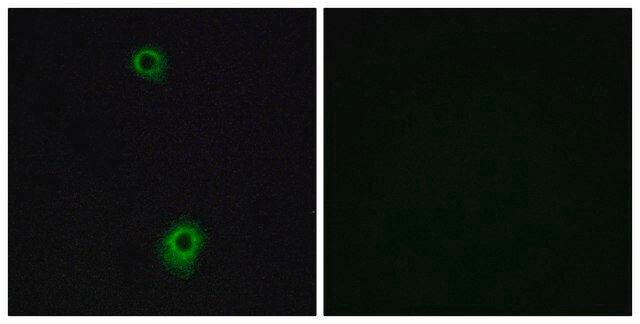 Anti-HTR1B antibody produced in rabbit affinity isolated antibody