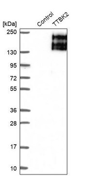 Anti-TTBK2 antibody produced in rabbit Prestige Antibodies&#174; Powered by Atlas Antibodies, affinity isolated antibody, buffered aqueous glycerol solution