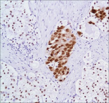 Anti-Androgen Receptor antibody, Rabbit monoclonal clone SP107, recombinant, expressed in proprietary host, affinity isolated antibody