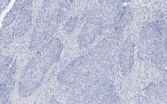 Anti-Integrin &#946;1 Antibody, clone 1A27 , ZooMAb&#174; Rabbit Monoclonal recombinant, expressed in HEK 293 cells