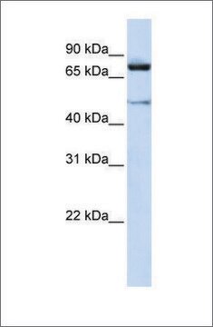 Anti-CUL2 antibody produced in rabbit affinity isolated antibody