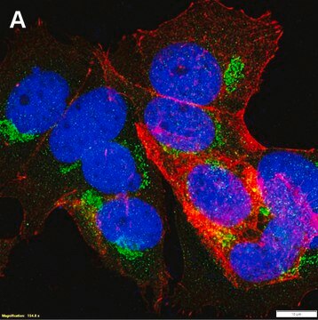 Anti-&#945;-amylase Antibody, clone 1G14 ZooMAb&#174; Rabbit Monoclonal recombinant, expressed in HEK 293 cells