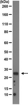 Anti-Transthyretin Antibody, clone 7G8-E11-E7 clone 7G8-E11-E7, from mouse