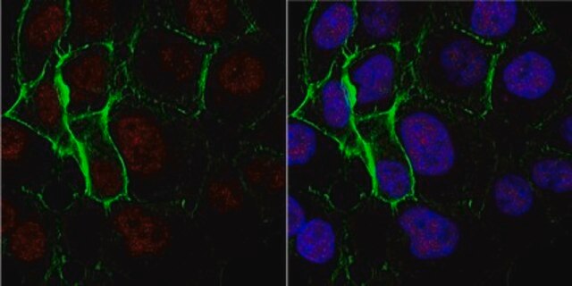 Anti-Nibrin/Nbs1 Antibody, clone EE15 (Ascites Free) clone EE15, from mouse