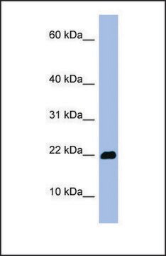 Anti-OMP antibody produced in rabbit affinity isolated antibody