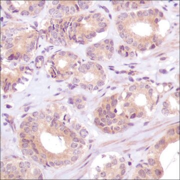 Anti-PTEN antibody, Rabbit monoclonal recombinant, expressed in proprietary host, clone SP170, affinity isolated antibody