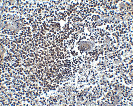 Anti-CXCR4 antibody produced in rabbit affinity isolated antibody