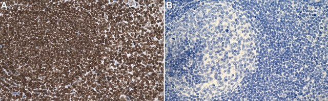 Anti-DNA Antibody, double stranded, clone AE-2 clone AE-2, Chemicon&#174;, from mouse