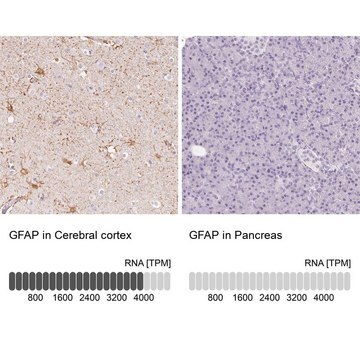 Anti-GFAP antibody produced in rabbit Prestige Antibodies&#174; Powered by Atlas Antibodies, affinity isolated antibody, buffered aqueous glycerol solution