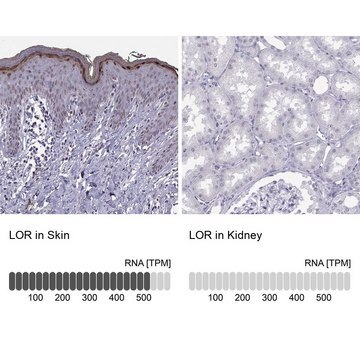 Anti-LOR Prestige Antibodies&#174; Powered by Atlas Antibodies, affinity isolated antibody