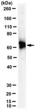 Anti-RPE65 Antibody, clone KPSA1