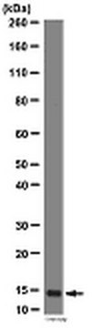 Anti-SUMO 2/3 Antibody from rabbit, purified by affinity chromatography