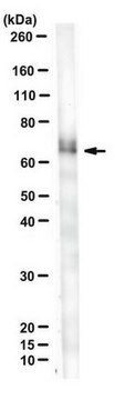 Anti-P40 (TP63) Antibody, clone 11H1 clone 11H1, from mouse