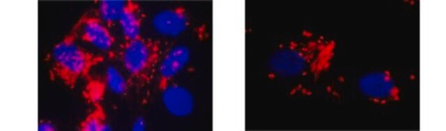 Anti-von Willebrand factor (vWF) Antibody, clone IIIE2.34 clone IIIE2.34, from mouse