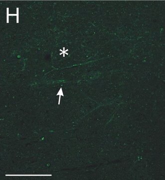 Anti-Chondroitin Sulfate Proteoglycan Antibody, Brain (core protein), clone Cat-301 clone Cat-301, Chemicon&#174;, from mouse