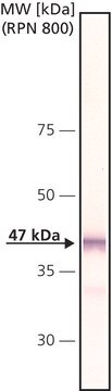 Anti-Glycogen Synthase Kinase-3&#946; (GSK-3&#946;) antibody produced in rabbit affinity isolated antibody, buffered aqueous solution