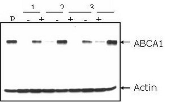 Anti-ABCA1 Antibody, clone AB.H10 clone AB.H10, Chemicon&#174;, from mouse