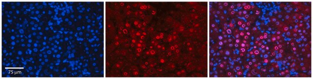 Anti-FOS antibody produced in rabbit affinity isolated antibody