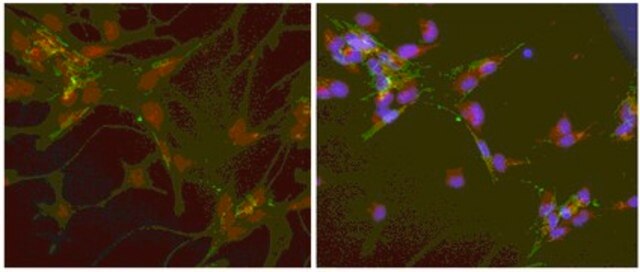 Anti-Fibroblast-specific Protein 1 (S100A4) Antibody from rabbit, purified by affinity chromatography