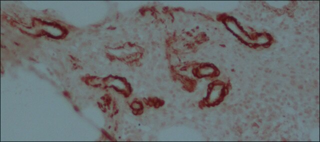 Anti-Maus-IgG (Gesamtmolekül)-Peroxidase in Kaninchen hergestellte Antikörper IgG fraction of antiserum, buffered aqueous solution