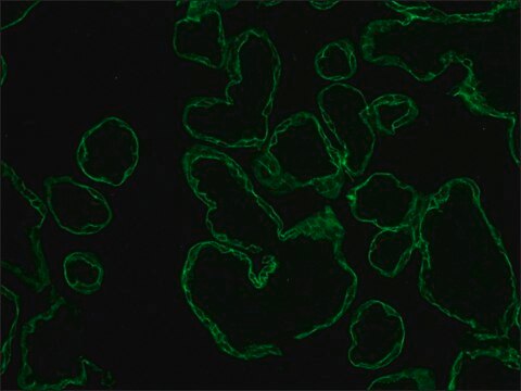 Anti-Cytokeratin pan-FITC antibody, Mouse monoclonal clone PCK-26, purified from hybridoma cell culture