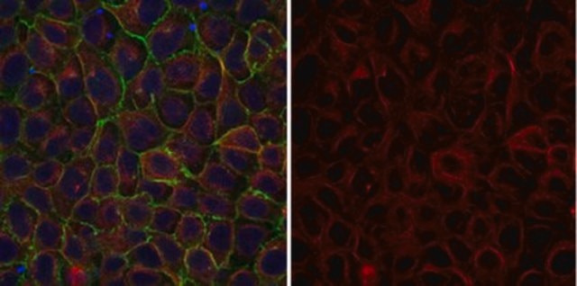 Anti-&#945;-Tubulin Antibody, clone DM1A, Alexa Fluor&#8482; 555 Conjugate clone DM1A, from mouse, ALEXA FLUOR&#8482; 555