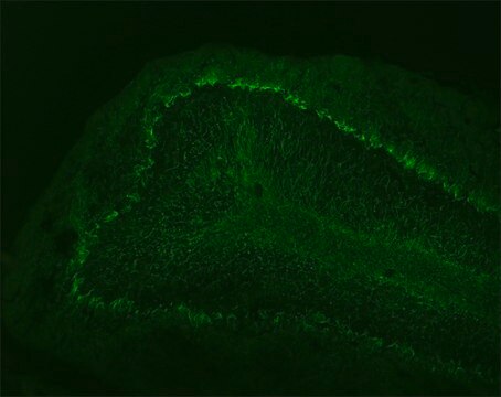 Monoclonal Anti-Neurofilament 68 antibody produced in mouse clone NR4, ascites fluid