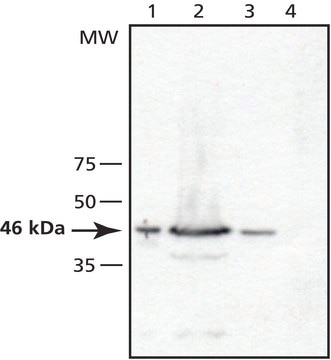 Anti-TSG101 (N-terminal) antibody produced in rabbit ~1&#160;mg/mL, affinity isolated antibody, buffered aqueous solution