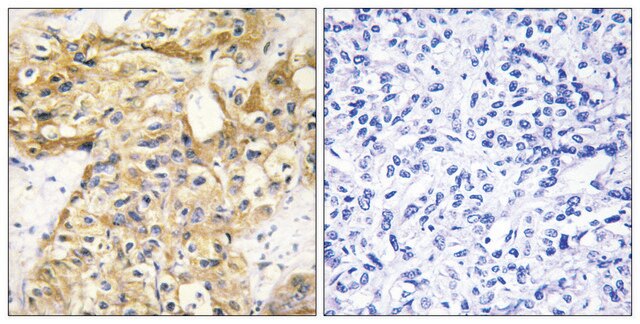 Anti-Collagen XVIII &#945;1 antibody produced in rabbit affinity isolated antibody