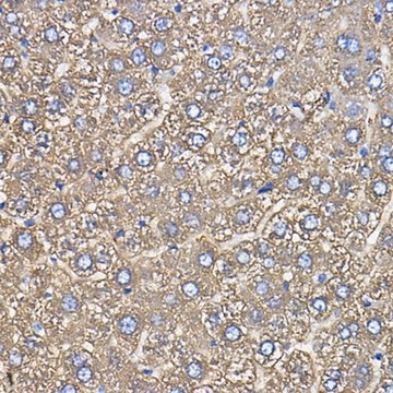 Anti-Ceruloplasmin antibody produced in rabbit