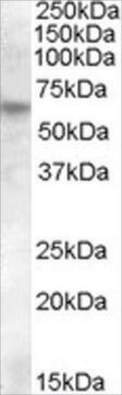 Anti-RPE65 antibody produced in goat affinity isolated antibody, buffered aqueous solution