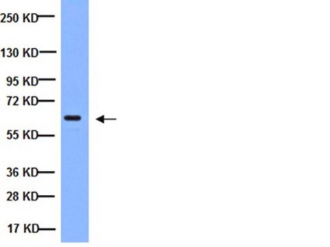 Anti-NF&#954;B Antibody, p65 subunit, active subunit, clone 12H11 clone 12H11, Chemicon&#174;, from mouse