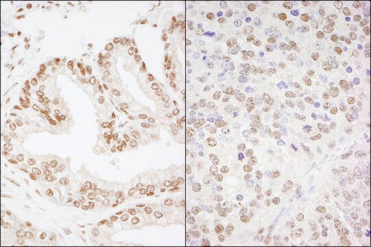 Rabbit anti-CREB Antibody, Affinity Purified Powered by Bethyl Laboratories, Inc.