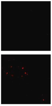 Anti-Amyloid-&#946; (oligomer) Antibody, clone F11G3 clone F11G3, from mouse