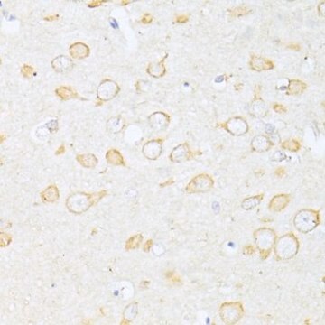 Anti-SQSTM1/p62 antibody produced in rabbit