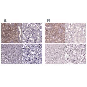 Anti-SFRP4 antibody produced in rabbit Prestige Antibodies&#174; Powered by Atlas Antibodies, affinity isolated antibody, buffered aqueous glycerol solution