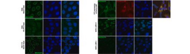 Anti-Lamin B Receptor (LBR) Antibody, clone BB2SS3F3 clone BB2SS3F3, from mouse