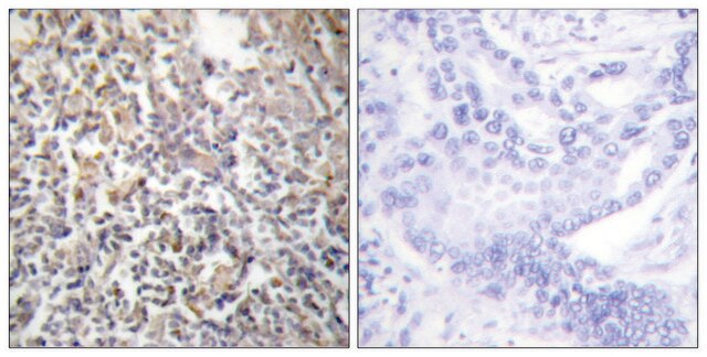 Anti-Fibronectin 1 antibody produced in rabbit affinity isolated antibody