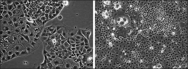 MRP5 Knockout Caco-2 Cells one vial