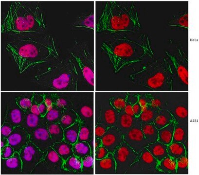 Anti-Replication Protein A Antibody, clone RPA34-20 clone RPA34-20, from mouse